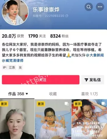 山东菏泽10岁男孩腹痛手术切除器官